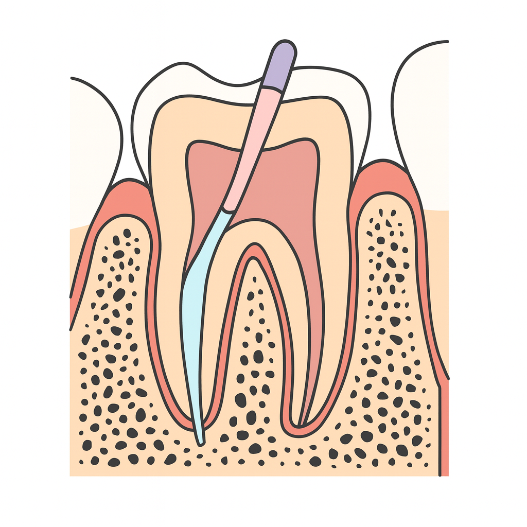 Bio ceramic sealers used in endodontics